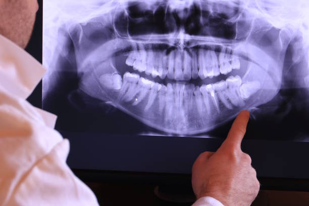 Best Emergency Dentist for Lost Fillings or Crowns in Llano Grande, TX